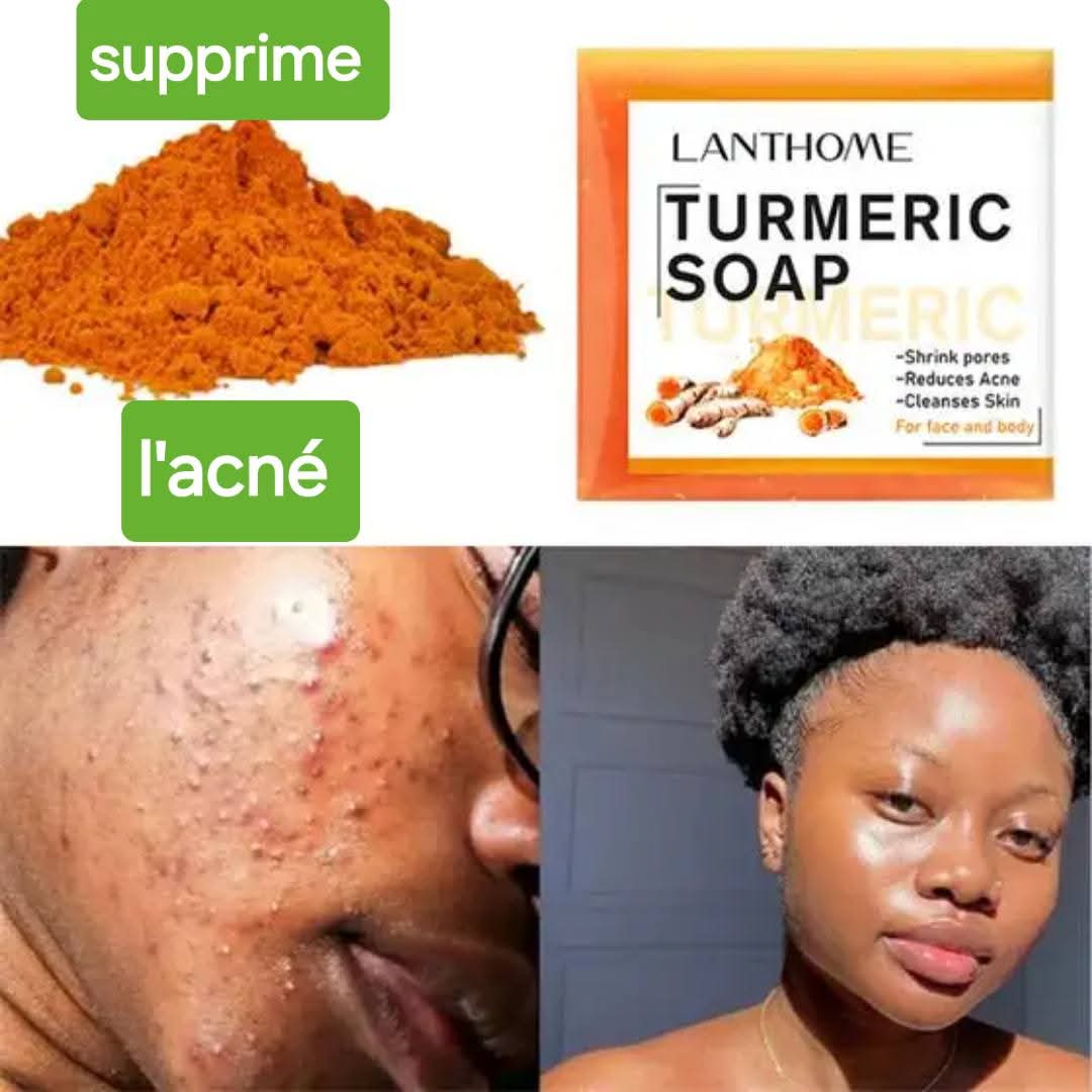 savon au curcuma, savon anti taches, soin visage naturel, savon éclat du teint.
